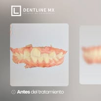 Dentline MX - Imagen 2