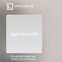 Dentline MX - Imagen 3